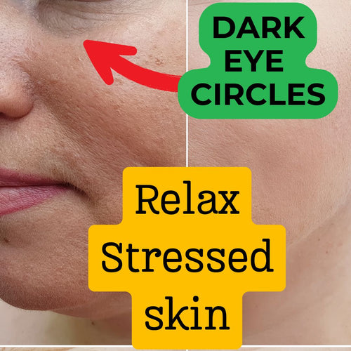 Get 2 Better skin Bundle:FaceLift Cream & Skin Clearing Serum+ FREE SHIPPING