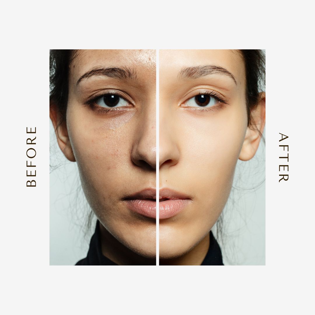 Get 2 Better skin Bundle:FaceLift Cream & Skin Clearing Serum (Save R699)
