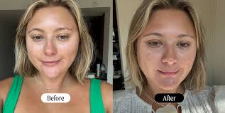 Get 2 Bundle:FaceLift Cream & Skin Clearing Serum (Save R499)