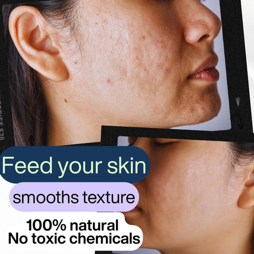 Get 2 Better skin Bundle:FaceLift Cream & Skin Clearing Serum+ FREE SHIPPING