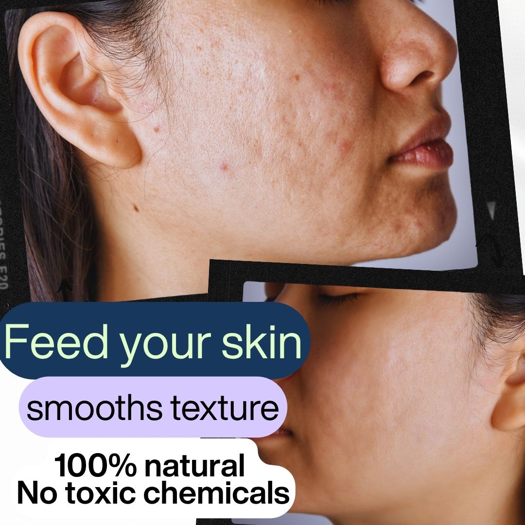 Get 2 Better skin Bundle:FaceLift Cream & Skin Clearing Serum (Save R699)