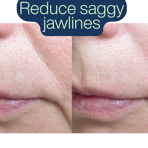 SculptFirm Rose Earth Stone Face Lifting Set + Free Luxury Bag + Free Shipping