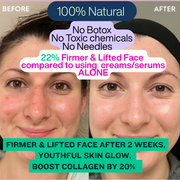 SculptFirm Rose Earth Stone Face Lifting Set + Free Luxury Bag + 30 day Skin Glow Up Bible