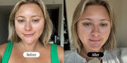 Get 2 Bundle:FaceLift Cream & Skin Clearing Serum (Save R499)